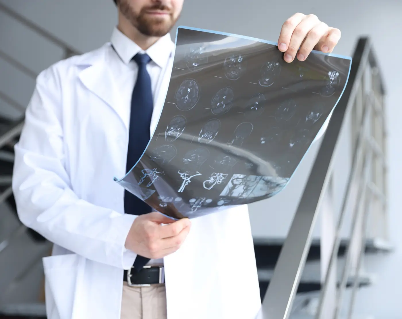 A doctor holding up brain MRI films